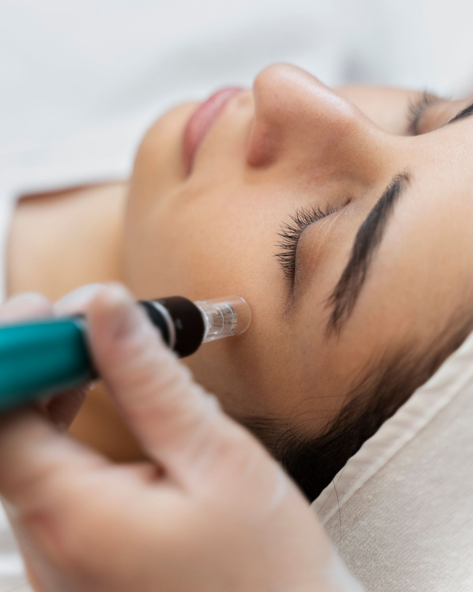 Electroporación facial Electropen