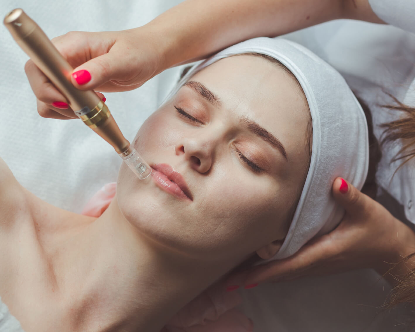 Microneedling Facial Dermapen en Takamaka